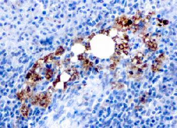 Anti-TRAcP (Tartrate-Resistant Acid Phosphatase) (Hairy Cell Leukemia Marker) Recombinant Mouse Monoclonal Antibody (Clone:rACP5/1070)