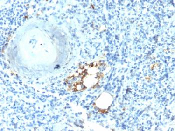 Anti-TRAcP (Tartrate-Resistant Acid Phosphatase) (Hairy Cell Leukemia Marker) Recombinant Rabbit Monoclonal Antibody (Clone:ACP5/2336R)