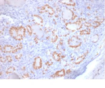 Anti-TTF-1 / NKX2.1 (Thyroid & Lung Epithelial Marker) Recombinant Mouse Monoclonal Antibody (Clone:rNX2.1/690)