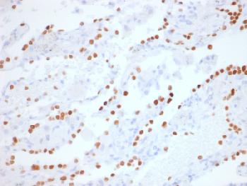 Anti-TTF-1 / NKX2.1 (Thyroid & Lung Epithelial Marker) Recombinant Rabbit Monoclonal Antibody (Clone:NX2.1/1855R)