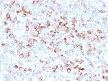 Anti-Tyrosinase (Melanoma Marker) Recombinant Mouse Monoclonal Antibody (Clone:rOCA1/812)