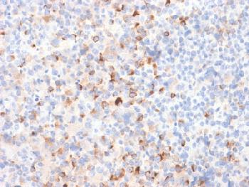 Anti-Tyrosinase (Melanoma Marker) Recombinant Rabbit Monoclonal Antibody (Clone:TYR/2024R)