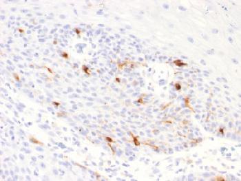 Anti-Tyrosinase-Related Protein-1 (TYRP-1) (Melanoma Marker) Recombinant Rabbit Monoclonal Antibody (Clone:TYRP1/2340R)