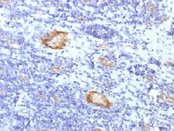 Anti-von Willebrand Factor / Factor VIII Related-Ag (Endothelial Marker) Recombinant Rabbit Monoclonal Antibody (Clone:VWF/1859R)