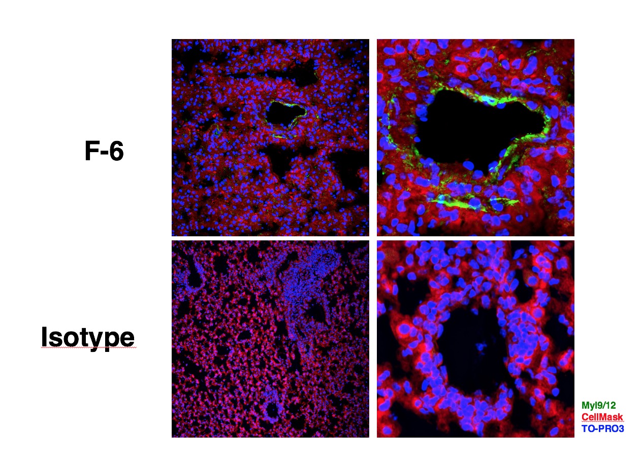 Human/Mouse Myl9/12 (Clone: F6) rabbit mAb