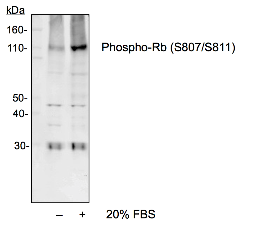 Phospho-Rb (Ser807/811) (Clone: D9) rabbit mAb