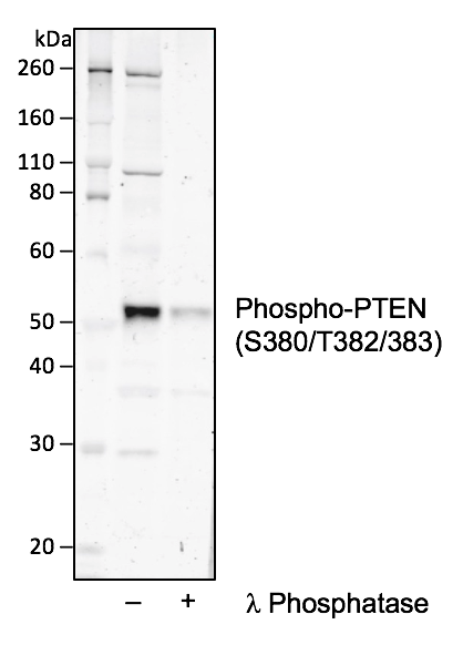 Phospho-PTEN (Ser380/Thr382/383) (Clone: E4) rabbit mAb