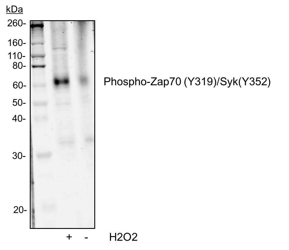 Phospho-Zap70 (Tyr319)/Syk (Tyr352) (Clone: A11) rabbit mAb