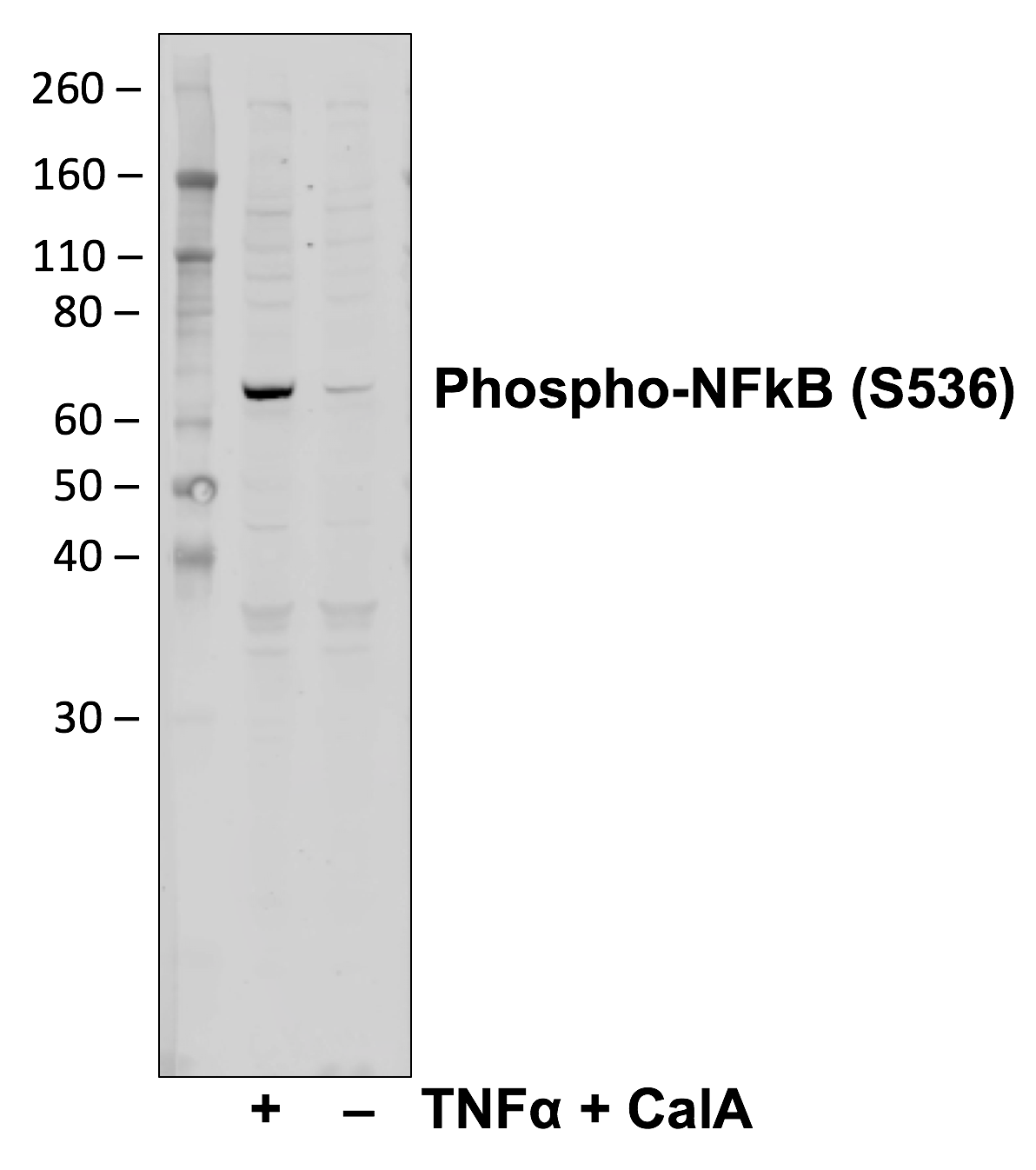 Phospho-NFkB p65 (Ser536) (Clone: C8) rabbit mAb