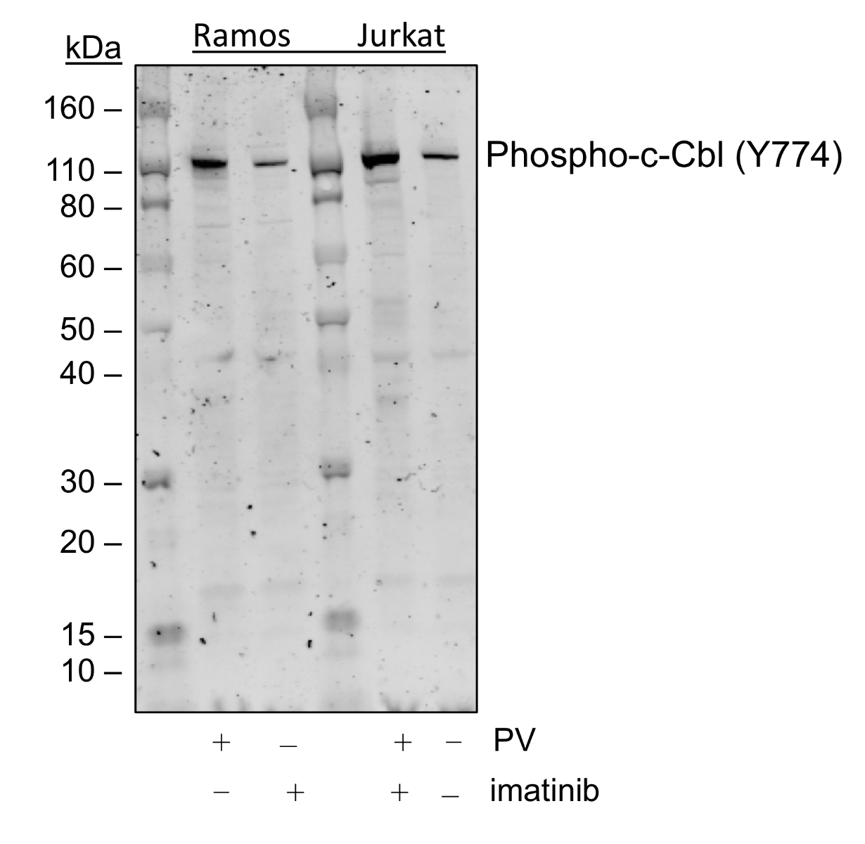 Phospho-c-Cbl (Tyr774) (Clone: R4C5) rabbit mAb