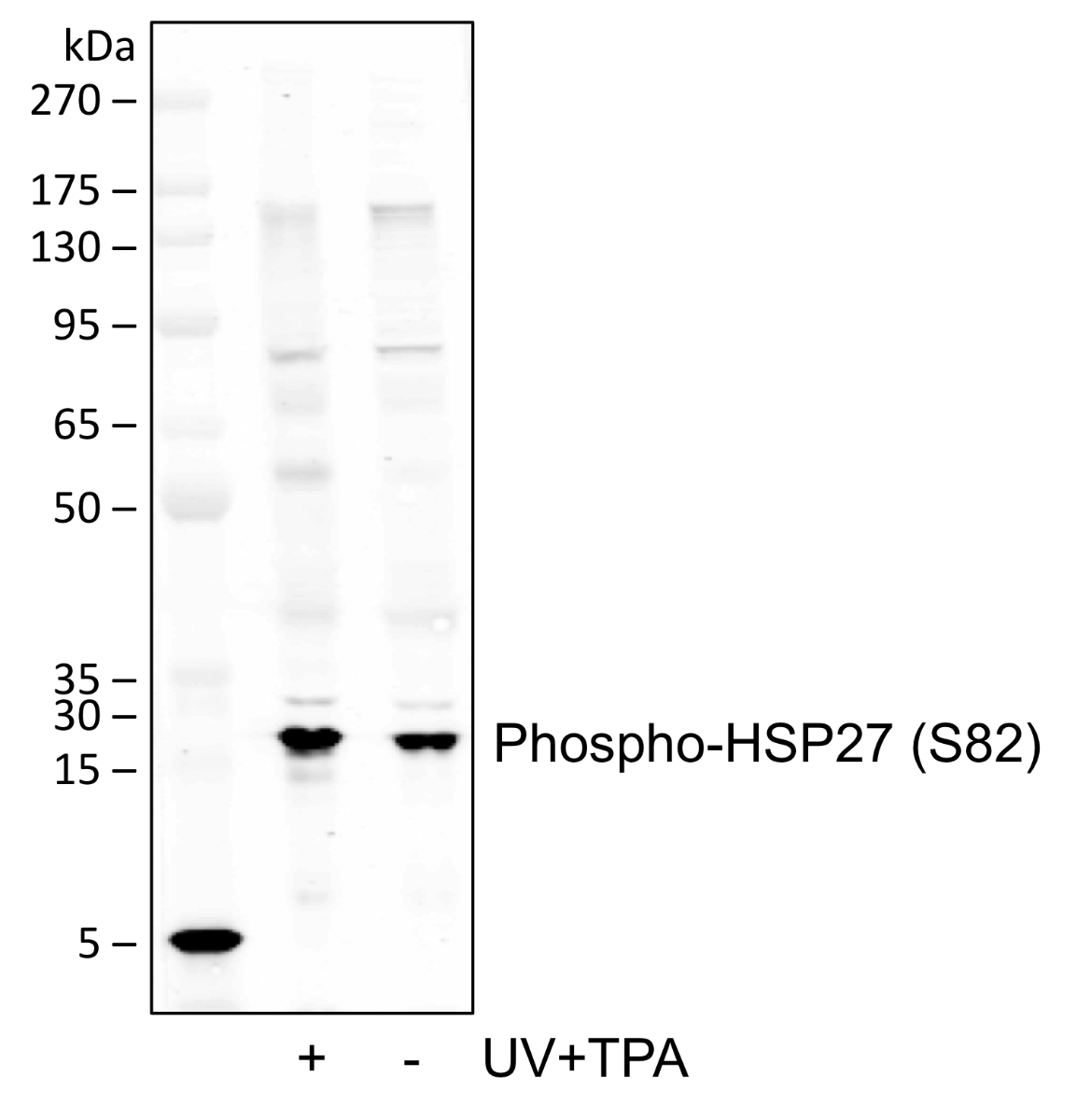 Phospho-HSP27 (Ser82) (Clone: CB2) rabbit mAb