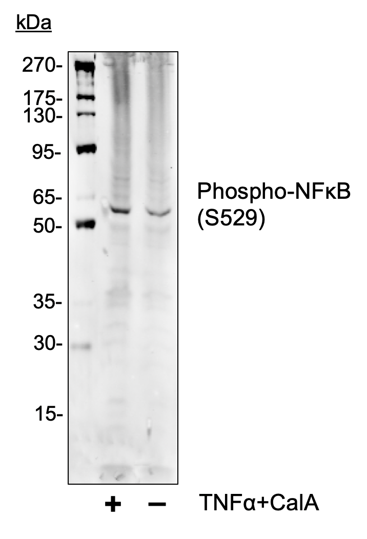 Phospho-NFkB p65 (Ser529) (Clone: A2) rabbit mAb