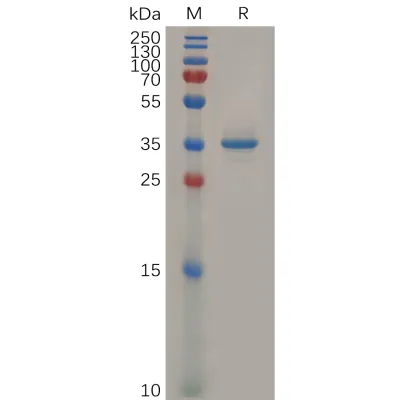 Anti-GPC3(Hu9F2) mAb