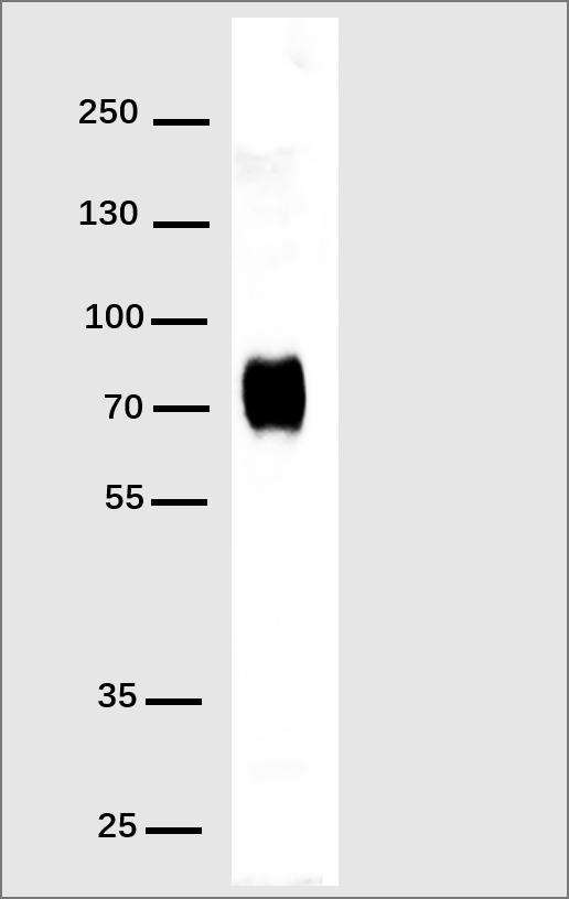 Anti-His Tag Antibody(DM1); Rabbit mAb