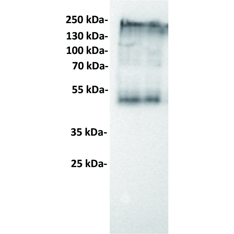 Anti-CEACAM5 antibody(1B5), IgG1 Chimeric mAb