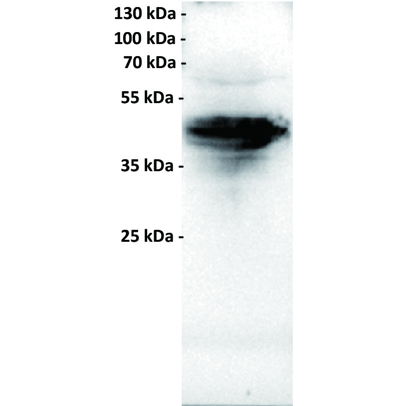 Anti-FOLR1 antibody(18A3), IgG1 Chimeric mAb