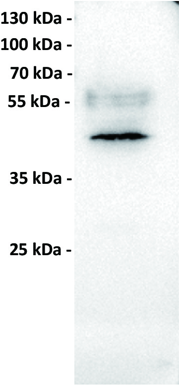 Anti-MICA antibody(7F12), IgG1 Chimeric mAb