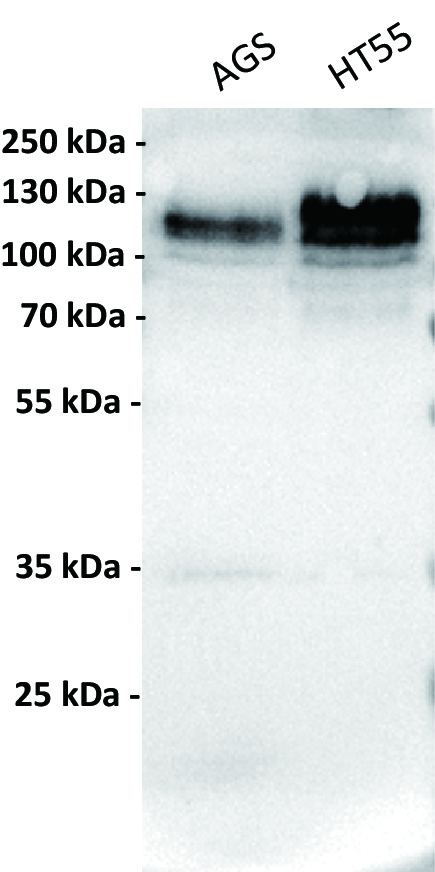 Anti-CDH17 antibody(5F5), IgG1 Chimeric mAb