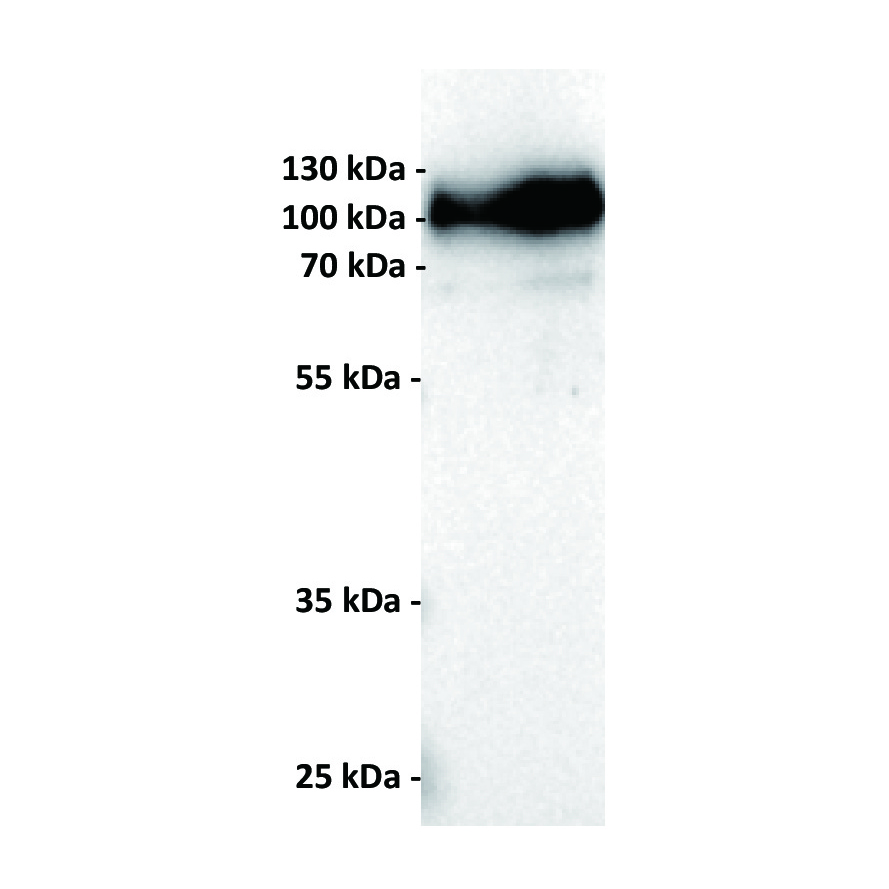 Anti-CD19 antibody(11B2), IgG1 Chimeric mAb