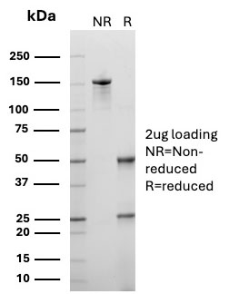 Neurofilament (H+L) (Neuronal Marker) Antibody (Clone: 2F11)