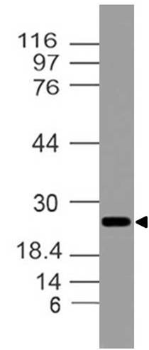 Polyclonal antibody to ASC/TMS1