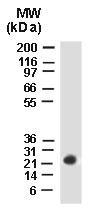 Polyclonal antibody to BAG2