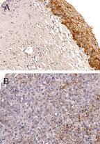 Polyclonal antibody to BAG5