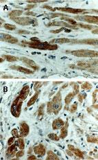 Polyclonal antibody to BAK