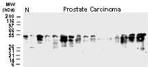 Polyclonal antibody to BFAR (BAR)