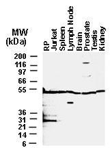 Polyclonal antibody to BFAR (BAR)