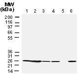 Polyclonal antibody to Bcl-2