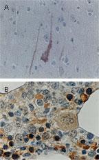 Polyclonal antibody to Bcl-xL