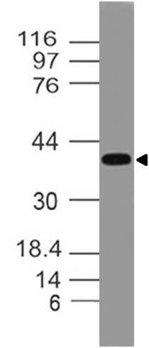 Polyclonal antibody to DEDD2 (DED4)