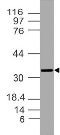 Polyclonal antibody to DEDD2 ( DED2/Flame-3 )