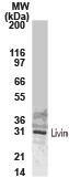 Polyclonal antibody to Livin (KIAP)