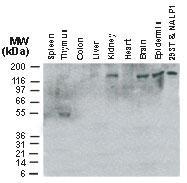 Polyclonal antibody to NLRP1/NALP1 (NAC-delta)