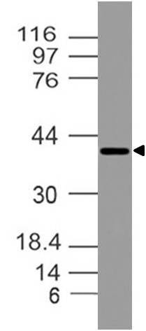 Polyclonal antibody to NIDD/ZDHHC23