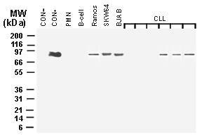 Polyclonal antibody to MALT-1 (Paracaspase)