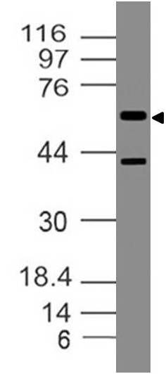 Polyclonal antibody to Semenogelin II