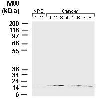 Polyclonal antibody to Survivin