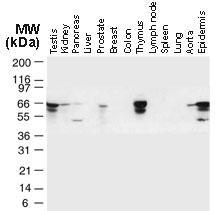 Polyclonal antibody to TRAF-6