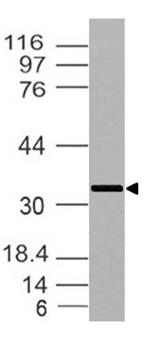 Polyclonal antibody to TRAIP (TRIP)