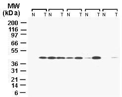 Polyclonal antibody to CARD8 (Tucan)