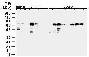 Polyclonal antibody to cIAP-1/HIAP-2