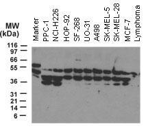 Polyclonal antibody to NOD2 (Card15)