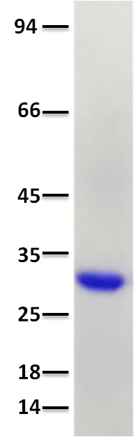 Recombinant SARS-CoV-2 Spike RBD Protein N-Term His Tag