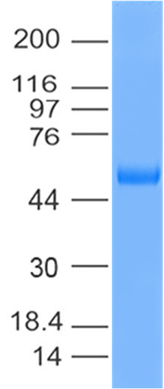 Recombinant SARS-Cov-2 Spike RBD Protein Fc Tag (319-541 aa)