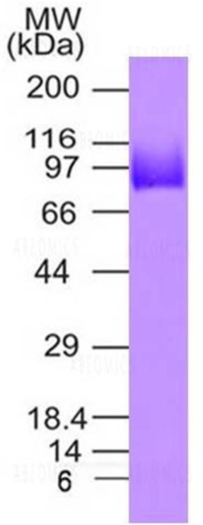 SARS CoV2 Spike S1 C-Term His Tag Protein