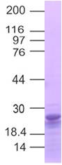 ACE2 Recombinant protein