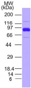 SARS-CoV-2 (2019-nCoV) Spike S1 South African Mutant (K417N / E484K / N501Y) His Tag Protein